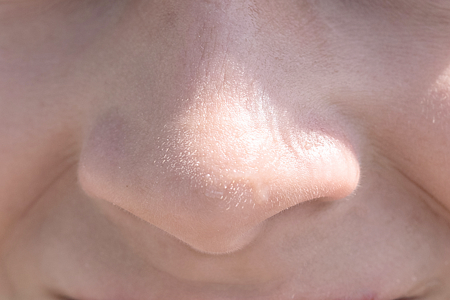 顎のザラつき ブツブツの正体は 原因とケアの方法をご紹介 あしたの美肌 専門家による美容コラム